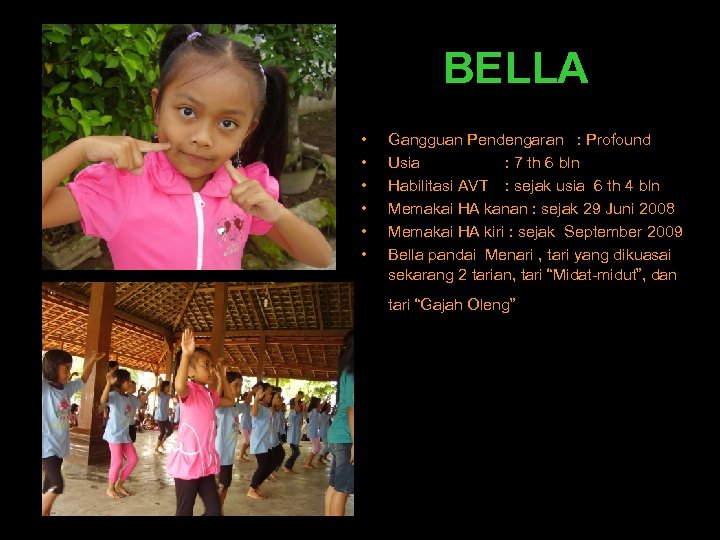 BELLA • • • Gangguan Pendengaran : Profound Usia : 7 th 6 bln