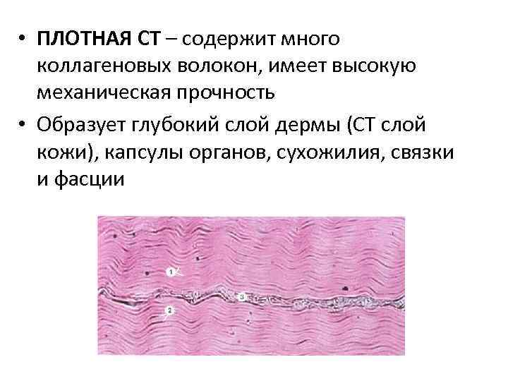  • ПЛОТНАЯ СТ – содержит много коллагеновых волокон, имеет высокую механическая прочность •