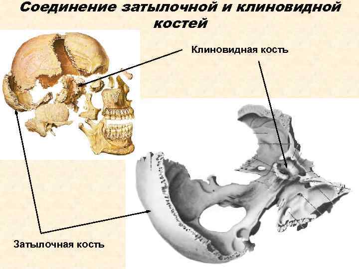 Соединение затылочной и клиновидной костей Клиновидная кость Затылочная кость 