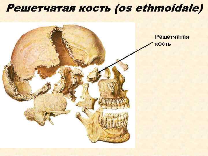 Решетчатая кость (os ethmoidale) Решетчатая кость 