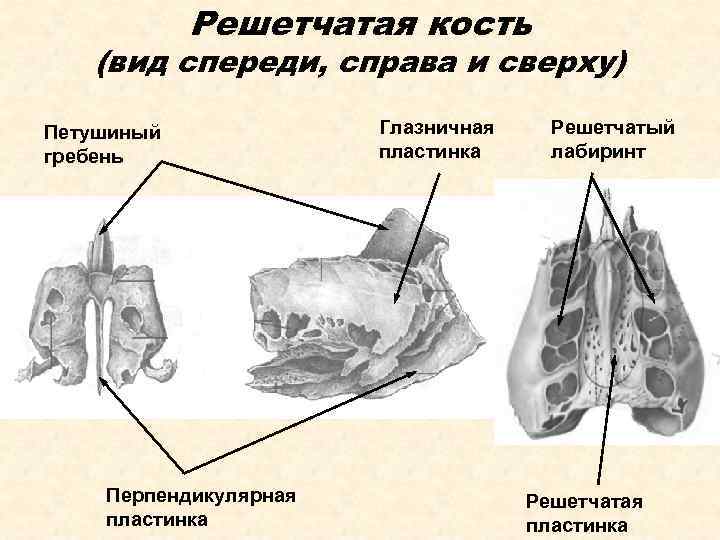 Решетчатая кость (вид спереди, справа и сверху) Петушиный гребень Перпендикулярная пластинка Глазничная пластинка Решетчатый