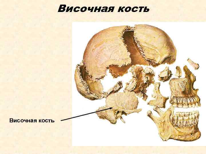 Височная кость 