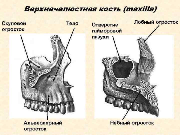 Верхнечелюстная кость (maxilla) Скуловой отросток Альвеолярный отросток Тело Отверстие гайморовой пазухи Лобный отросток Небный