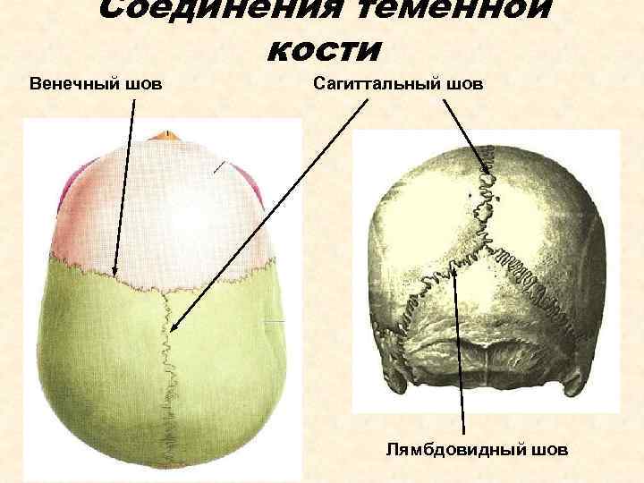 Соединения теменной кости Венечный шов Сагиттальный шов Лямбдовидный шов 