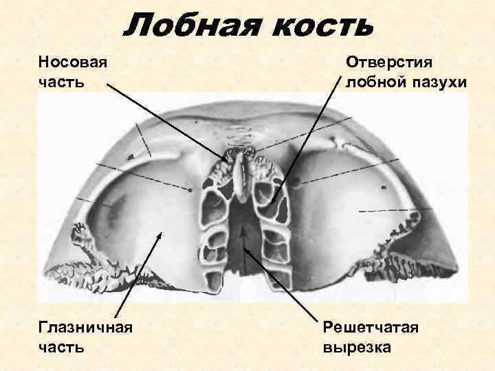 Лобная кость Носовая часть Глазничная часть Отверстия лобной пазухи Решетчатая вырезка 