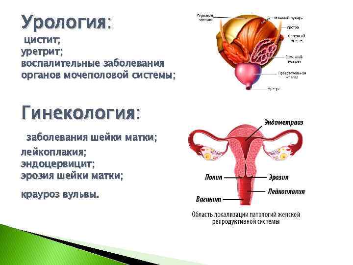 Воспалительные заболевания женских органов гинекология презентация