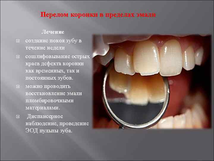 Перелом коронки в пределах эмали Лечение создание покоя зубу в течение недели сошлифовывание острых