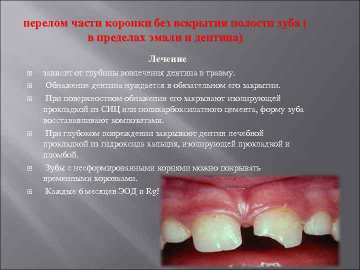 перелом части коронки без вскрытия полости зуба ( в пределах эмали и дентина) Лечение