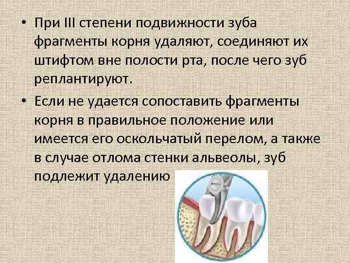 Степень удаления. Степени подвижности зуба. Подвижность зубов 3 степени. Вторая степень подвижности зубов. Третья степень подвижности зуба.