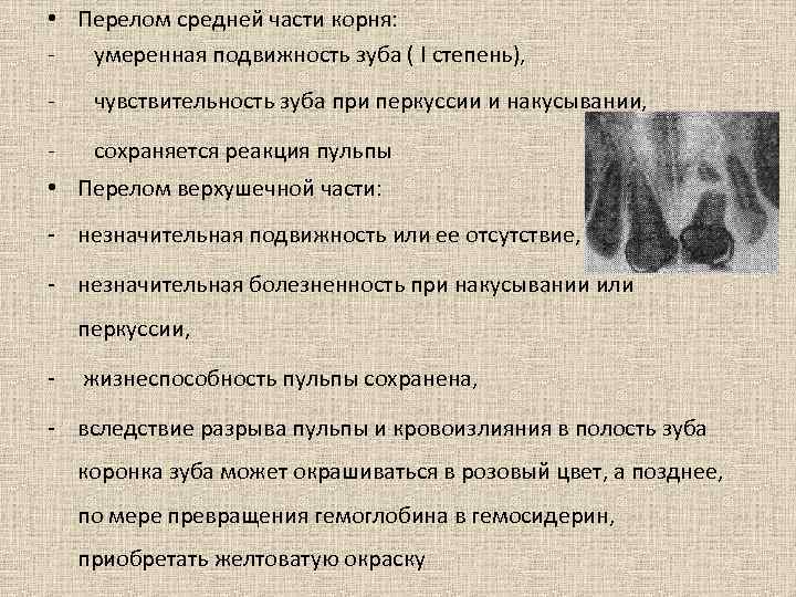  • Перелом средней части корня: - умеренная подвижность зуба ( I степень), -