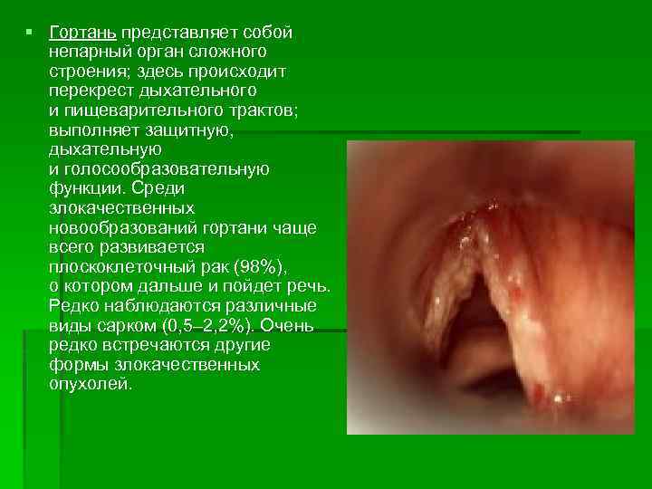 § Гортань представляет собой непарный орган сложного строения; здесь происходит перекрест дыхательного и пищеварительного