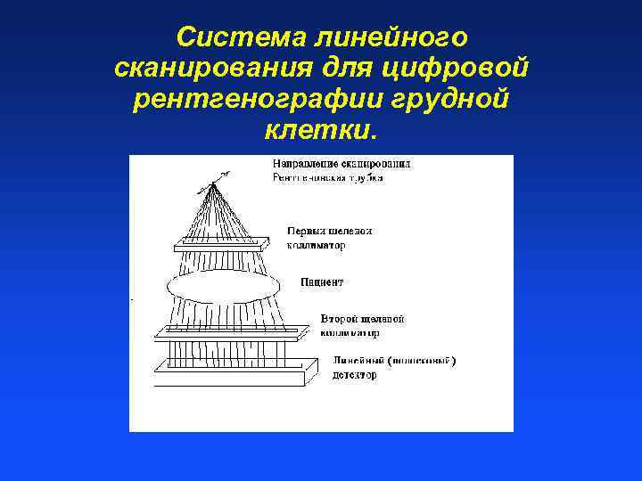Система линейного сканирования для цифровой рентгенографии грудной клетки. 