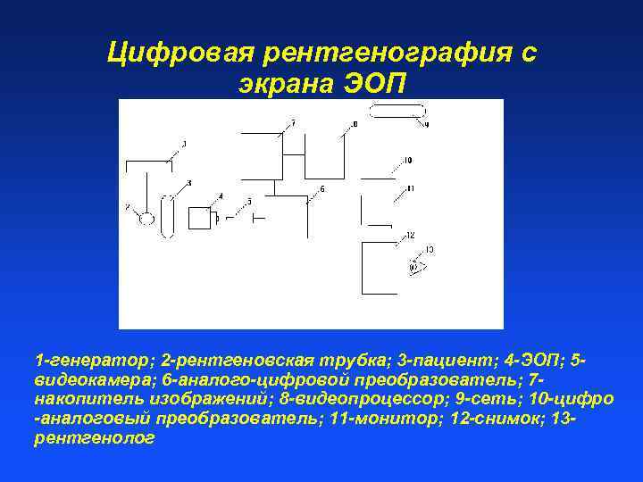 Цифровая рентгенография с экрана ЭОП. 1 -генератор; 2 -рентгеновская трубка; 3 -пациент; 4 -ЭОП;