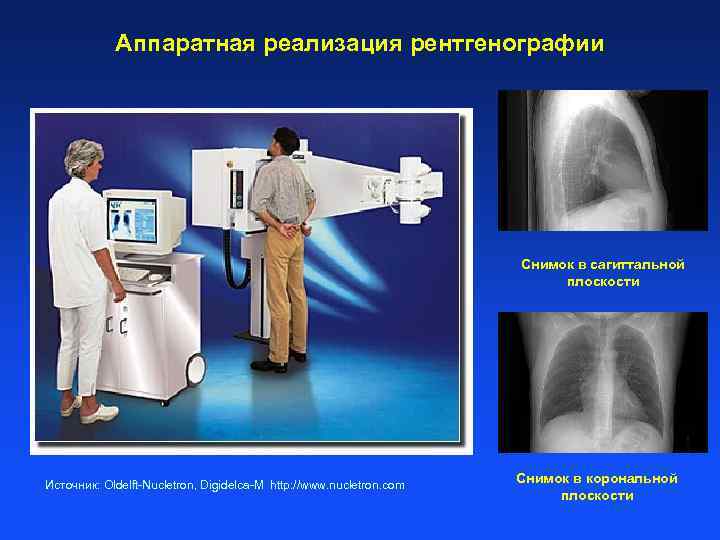 Аппаратная реализация рентгенографии Снимок в сагиттальной плоскости Источник: Oldelft-Nucletron, Digidelca-M http: //www. nucletron. com