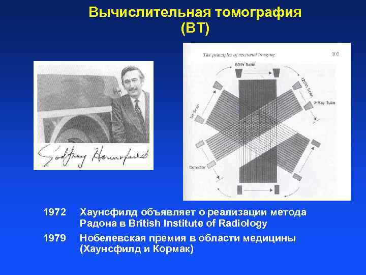 Вычислительная томография (ВТ) Result: 1972 1979 Хаунсфилд объявляет о реализации метода Радона в British