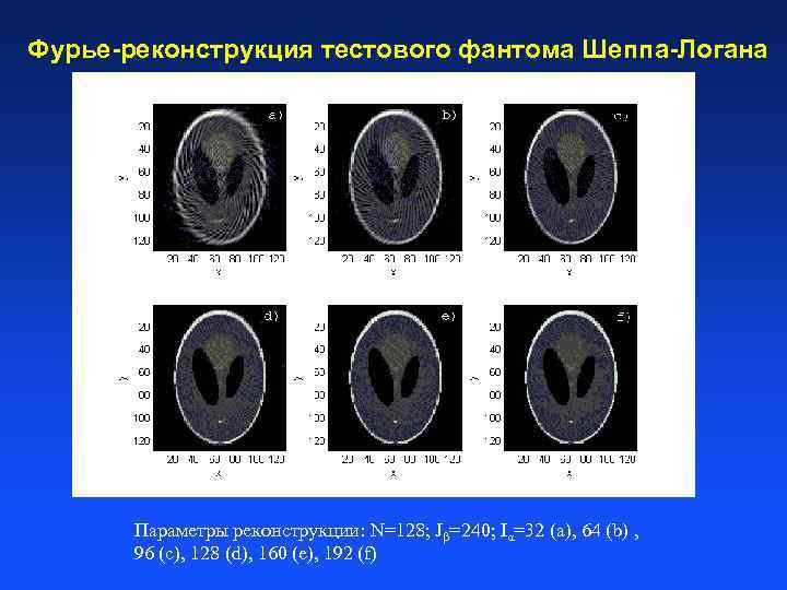 Фурье-реконструкция тестового фантома Шеппа-Логана Параметры реконструкции: N=128; Jβ=240; Iα=32 (a), 64 (b) , 96