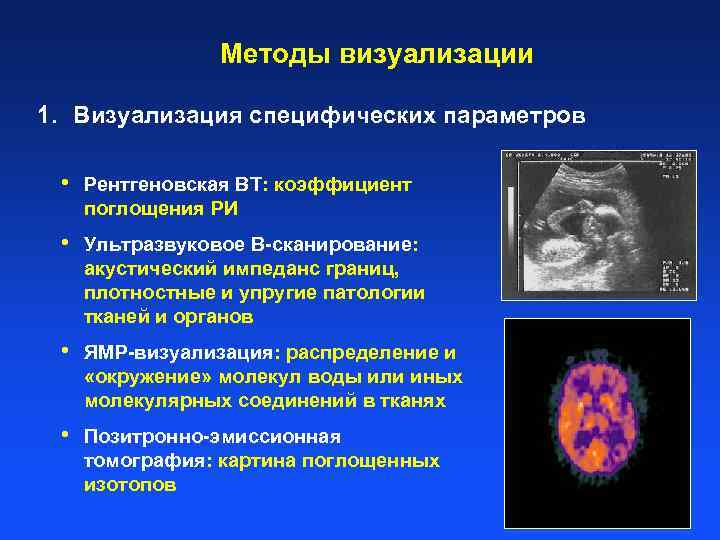 Методы визуализации 1. Визуализация специфических параметров • Рентгеновская ВТ: коэффициент поглощения РИ • Ультразвуковое