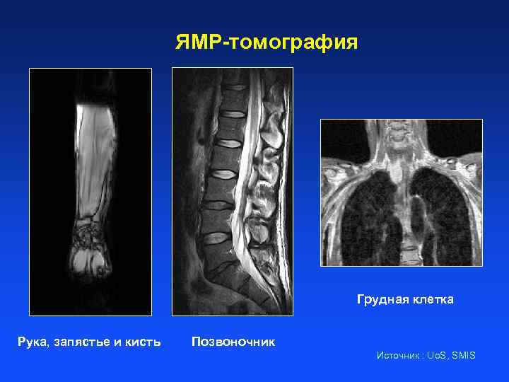 ЯМР-томография Грудная клетка Рука, запястье и кисть Позвоночник Источник : Uo. S, SMIS 