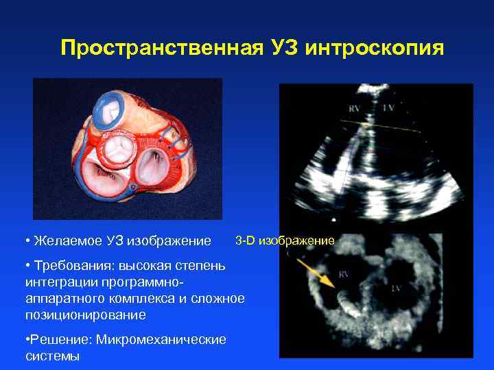  Пространственная УЗ интроскопия • Желаемое УЗ изображение 3 -D изображение • Требования: высокая