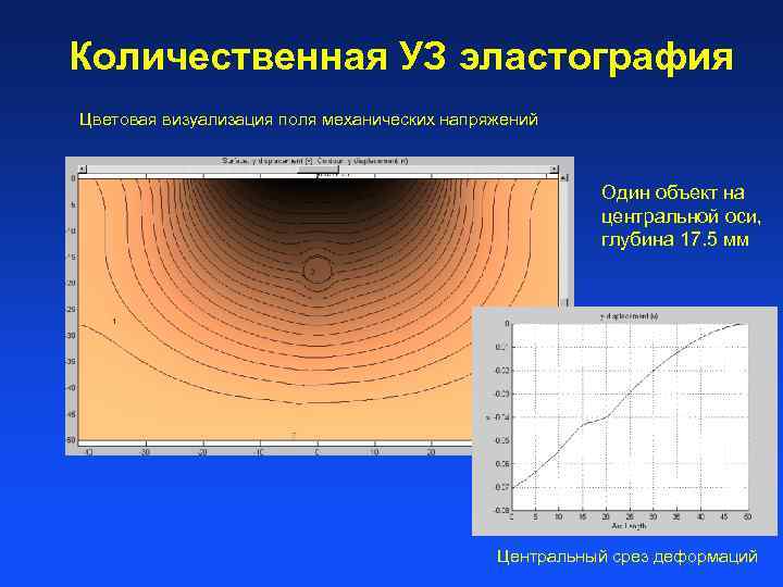 Количественная УЗ эластография Цветовая визуализация поля механических напряжений Один объект на центральной оси, глубина