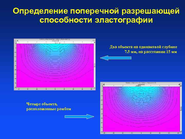 Определение поперечной разрешающей способности эластографии Два объекта на одинаковой глубине 7. 5 мм, на