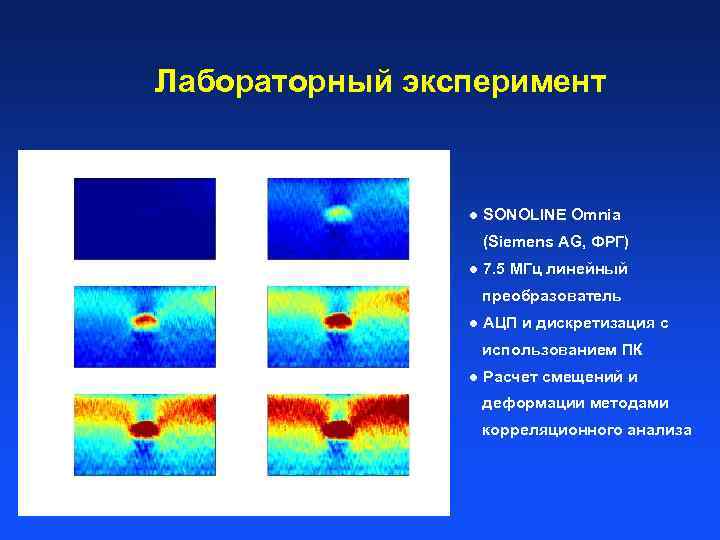 Лабораторный эксперимент l SONOLINE Omnia (Siemens AG, ФРГ) l 7. 5 МГц линейный преобразователь