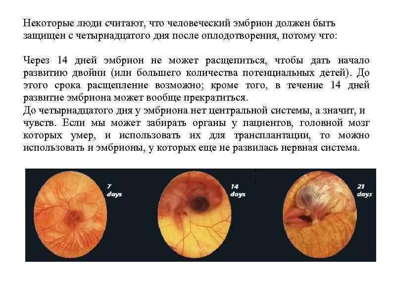 Некоторые люди считают, что человеческий эмбрион должен быть защищен с четырнадцатого дня после оплодотворения,