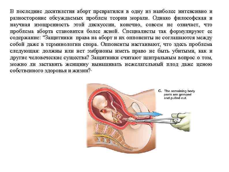 В последние десятилетия аборт превратился в одну из наиболее интенсивно и разносторонне обсуждаемых проблем