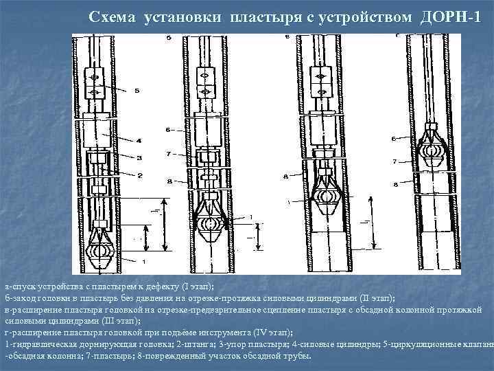 Схема установки пластыря с устройством ДОРН-1 а спуск устройства с пластырем к дефекту (I