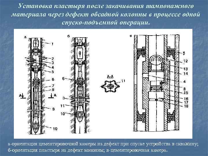 Установка пластыря после закачивания тампонажного материала через дефект обсадной колонны в процессе одной спуско-подъемной