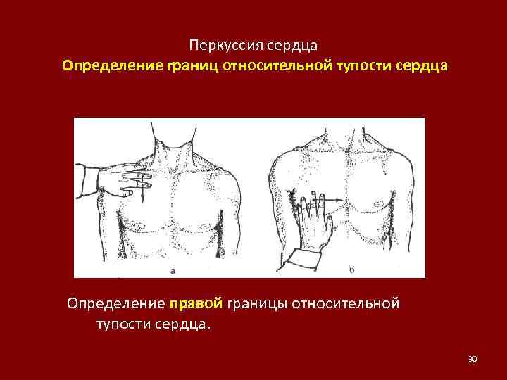 Границы относительной тупости сердца. Относительная тупость сердца перкуссия норма. Перкуссия границ относительной сердечной тупости. Определите границы относительной сердечной тупости. Относительная сердечная тупость определение.