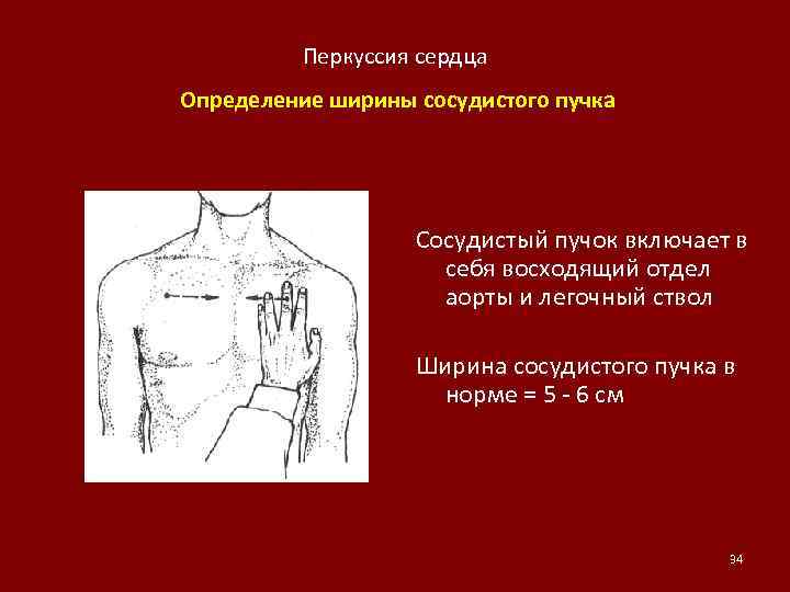 Перкуссия сердца. Поперечник сосудистого пучка в норме. Методика определения ширины сосудистого пучка. Ширина сосудистого пучка во 2-м межреберье. Ширина сосудистого пучка сердца.