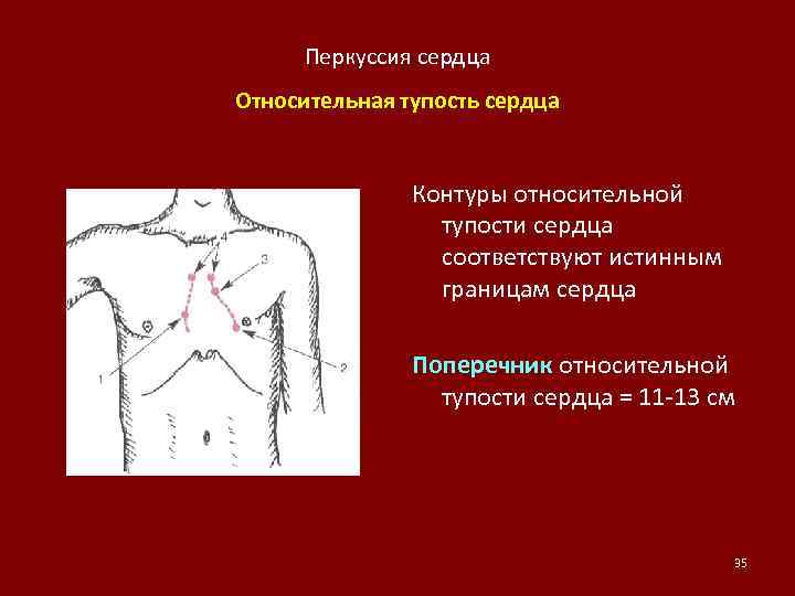 Схема перкуссия сердца