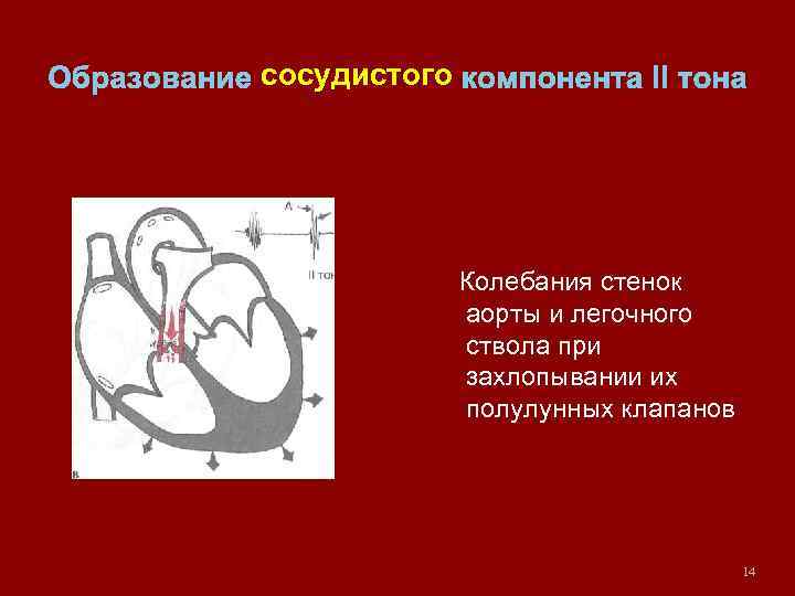 Образование сосудистого компонента II тона Колебания стенок аорты и легочного ствола при захлопывании их