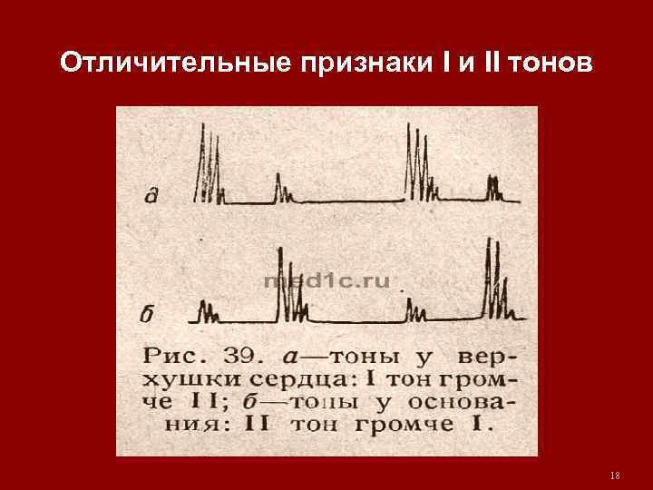 Отличительные признаки I и II тонов 18 