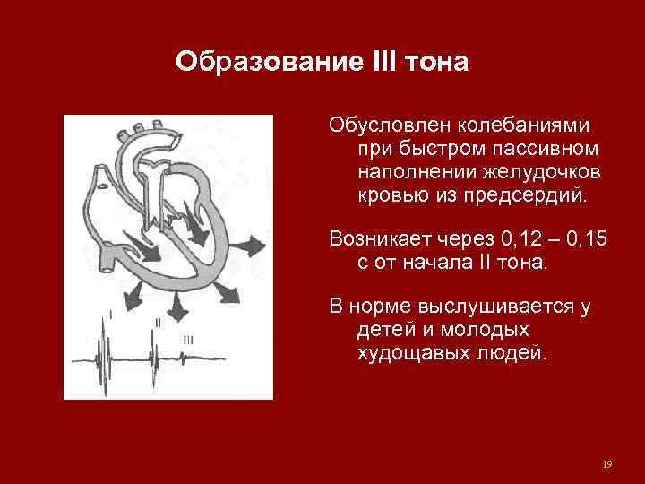 Образование III тона Обусловлен колебаниями при быстром пассивном наполнении желудочков кровью из предсердий. Возникает