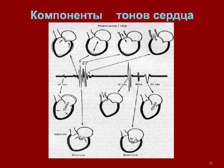 Компоненты тонов сердца 21 