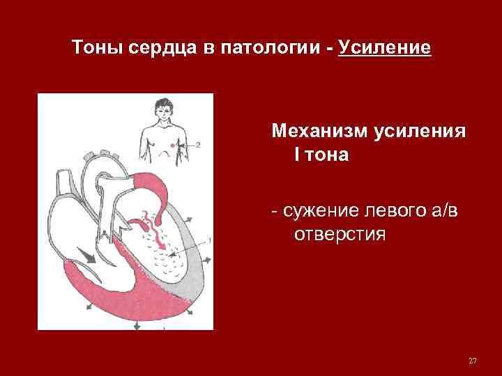 Характер сердца. Компонент второго тона сердца. Компоненты 2 тона сердца. Тоны сердца патология. Патологические тоны сердца.