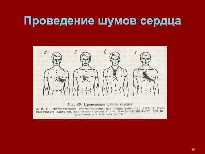 Проведение шумов сердца 39 