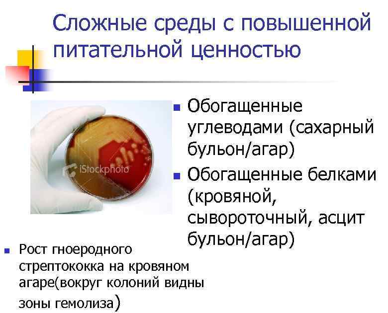 Сложные среды с повышенной питательной ценностью n n n Обогащенные углеводами (сахарный бульон/агар) Обогащенные
