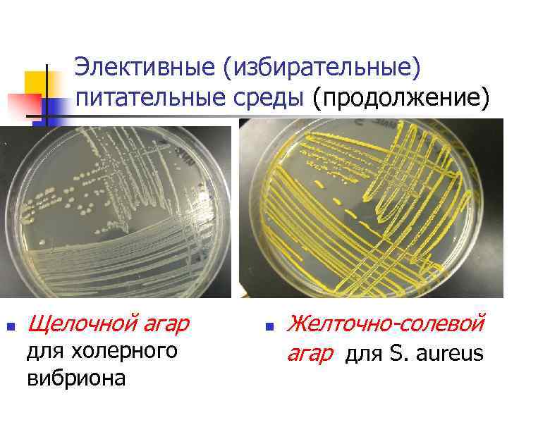 Элективные (избирательные) питательные среды (продолжение) n Щелочной агар для холерного вибриона n Желточно-солевой агар