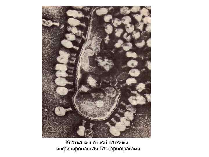 Клетка кишечной палочки, инфицированная бактериофагами 