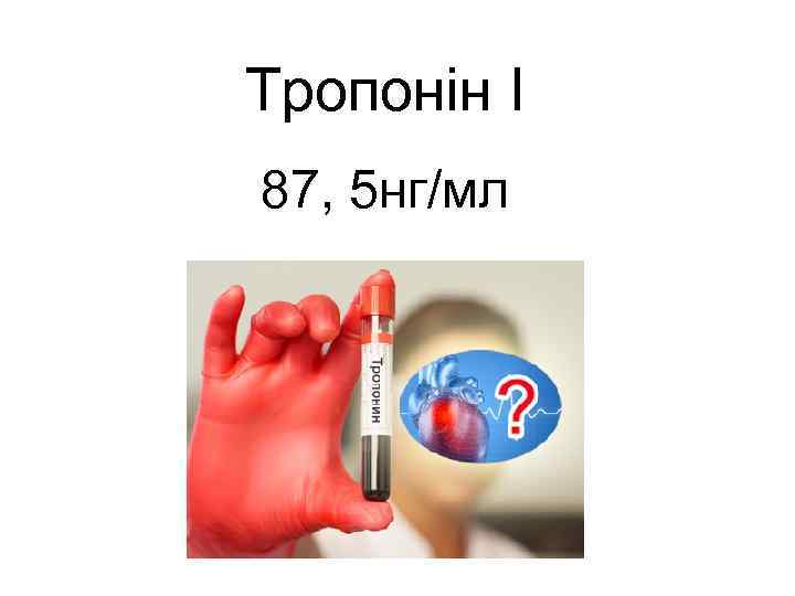 Тропонін І 87, 5 нг/мл 