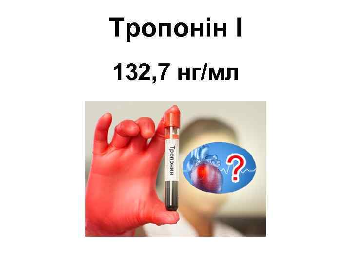 Тропонін І 132, 7 нг/мл 