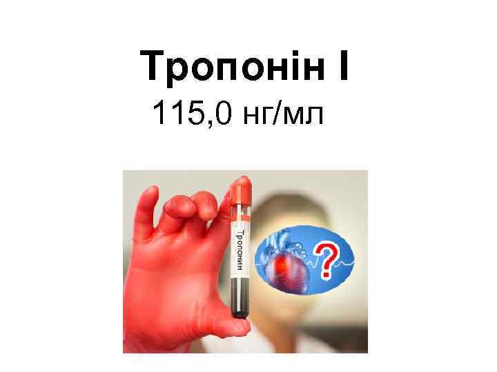 Тропонін І 115, 0 нг/мл 