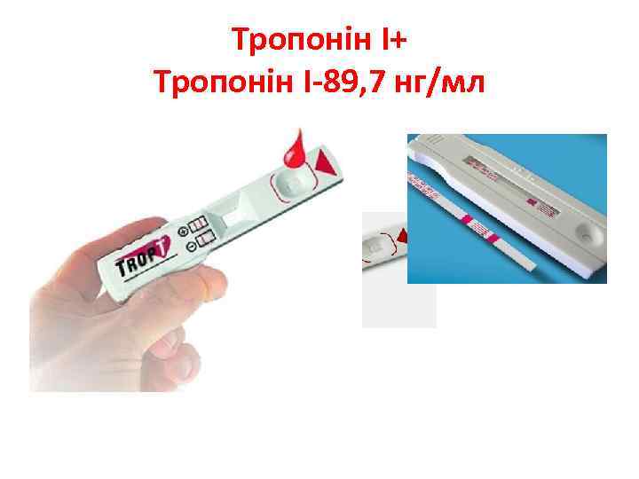 Тропонін І+ Тропонін І-89, 7 нг/мл 