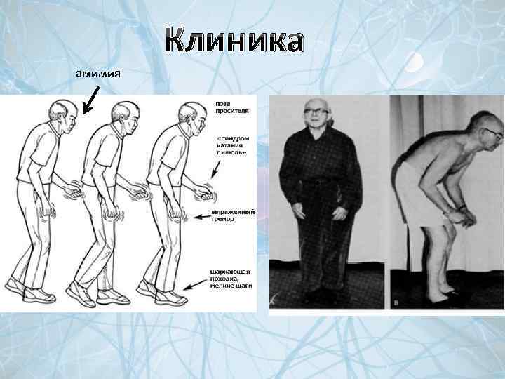 Клиника амимия 