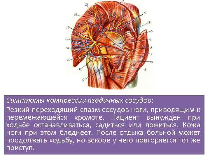 Симптомы компрессии ягодичных сосудов: Резкий переходящий спазм сосудов ноги, приводящим к перемежающейся хромоте. Пациент