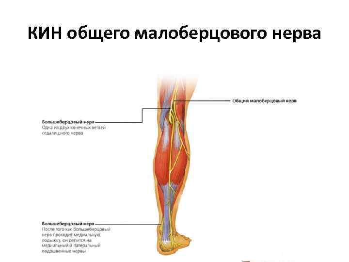 КИН общего малоберцового нерва синдром Гийена — Сеза — Де Блондена — Вальтера =