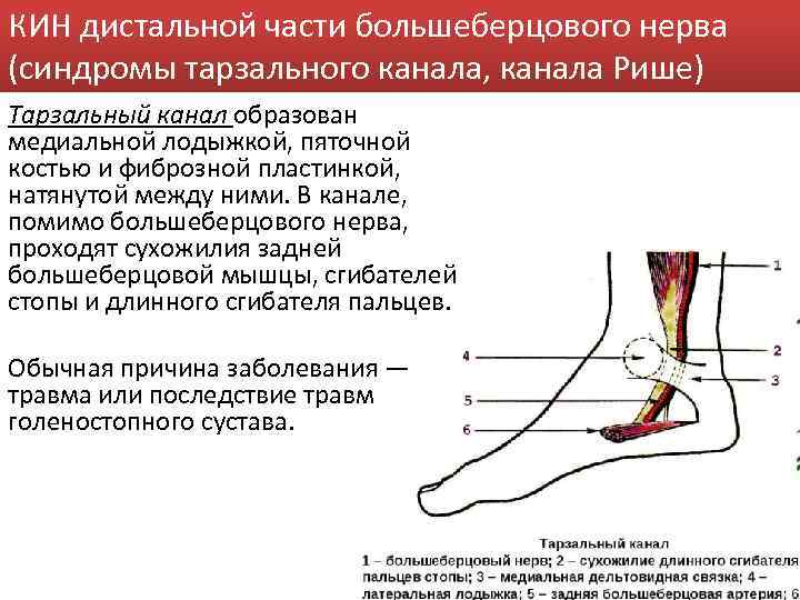 КИН дистальной части большеберцового нерва (синдромы тарзального канала, канала Рише) Тарзальный канал образован медиальной